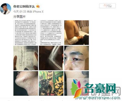 仙洋巴扎黑聊城打架视频曝光 快手上最大的网黑（仙家军）天天干仗