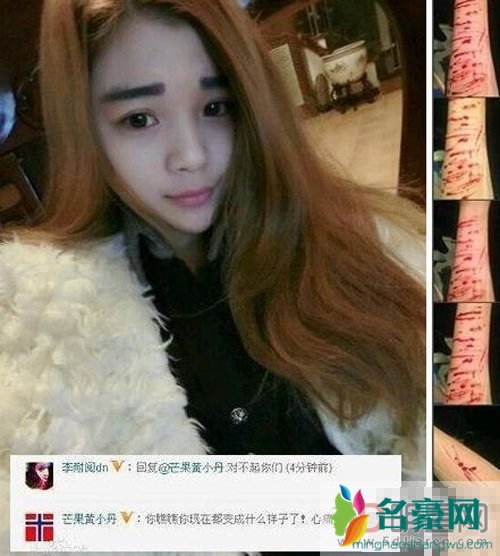 李耐阅堕胎了吗 整容堕胎自残手臂图片曝光