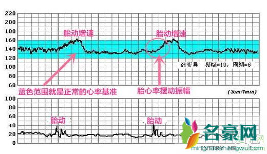 孕晚期每周都要做胎心监护吗 胎心监护很重要千万别怕麻烦3