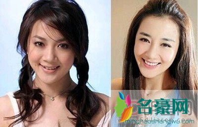 李依晓大方承认整容 以前的照片像极了韩国微笑女王