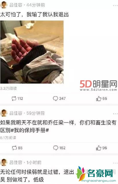 吕佳容晒受伤照称被高层迫害 领誉传媒CEO周昊牵出大批艺人