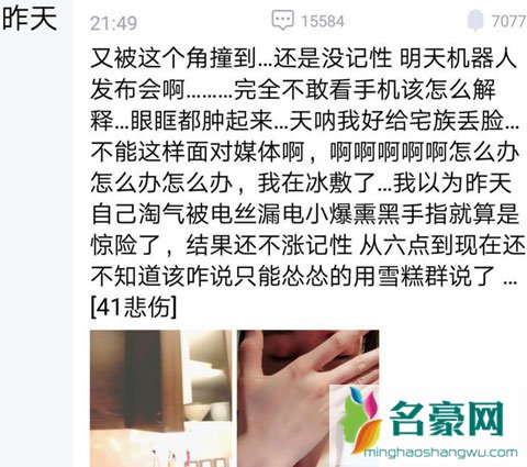 郑爽《这就是铁甲》发布会前受伤 整只眼睛敷纱布伤情严重