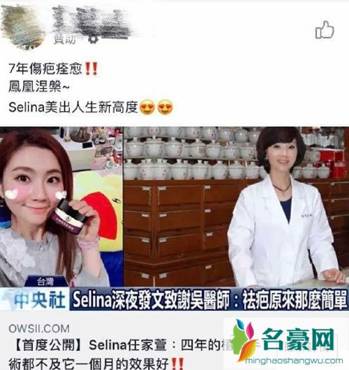 无良商家用Selina照片ps打去疤广告 戳人家痛处太无耻