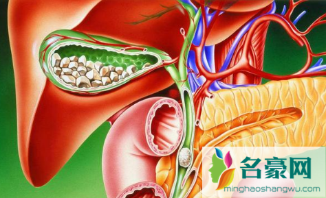 诊断胰腺炎但一直不疼严重吗2