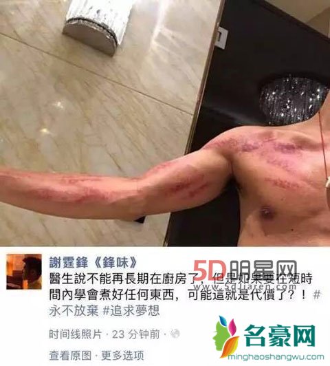 谢霆锋手筋膜发炎被禁入厨房 谢霆锋手筋膜发炎行程节目延期